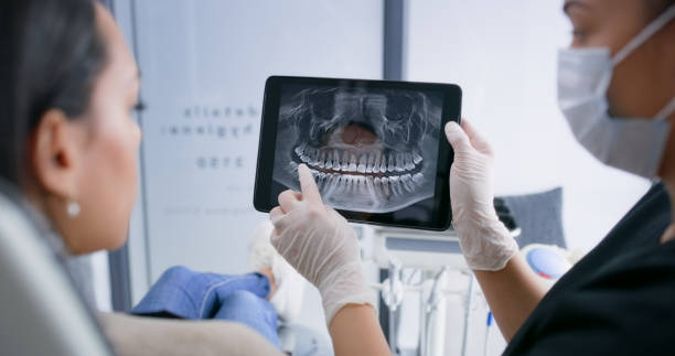 Licensed Teeth Whitening service in East Grand Forks, MN - Smile Center Dentistry